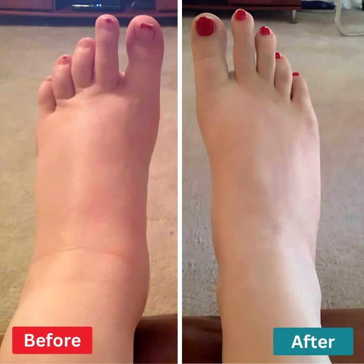 Massageador - Foot Massager