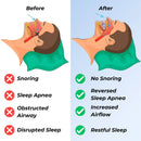 Griqos™ Anti Snoring Mouthpiece - Say goodbye to sleepless nights